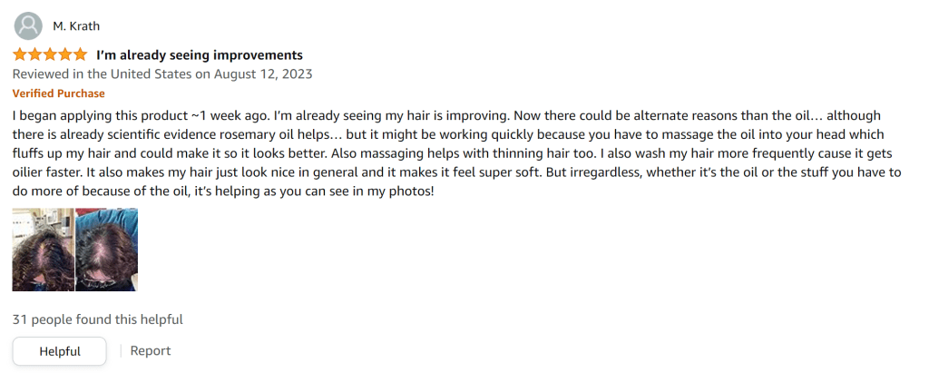 Seeing hair improvements after 1 week of rosemary oil use