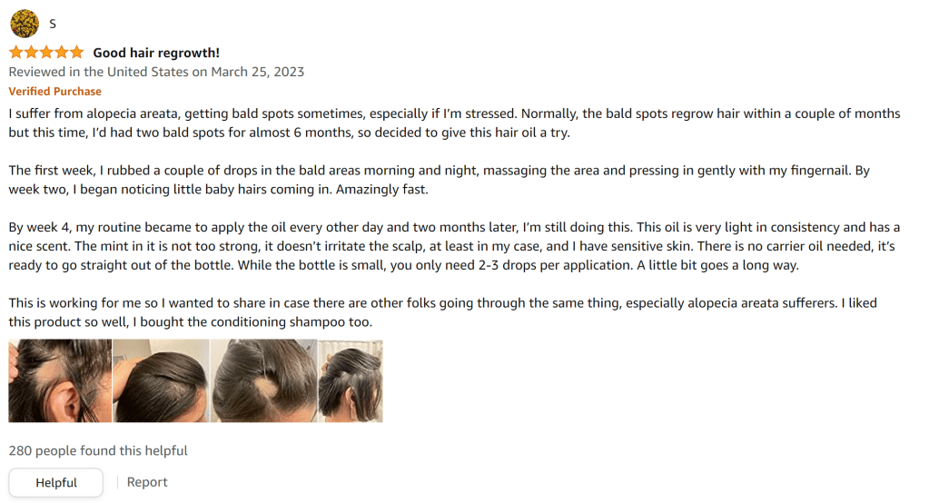 Rosemary oil is great for getting rid of bald spots from alopecia areata. I had two bald spots that the oil helped me regrow. before and after pictures included.