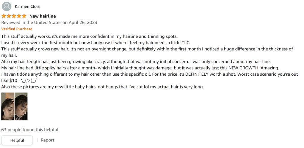 Rosemary oil gave me a new hairline and grew back thinning spots. It grows new hair. includes before and after pictures of hair regrowth.