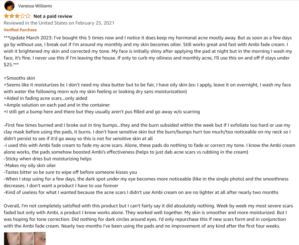 Glycolic acid pads are great for hormonal acne and fading acne scars.